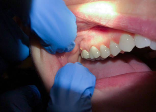 Best Weekend Emergency Dentist in Milroy, PA